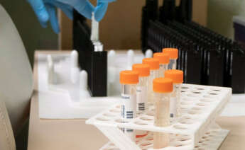 Casos de viruela del mono