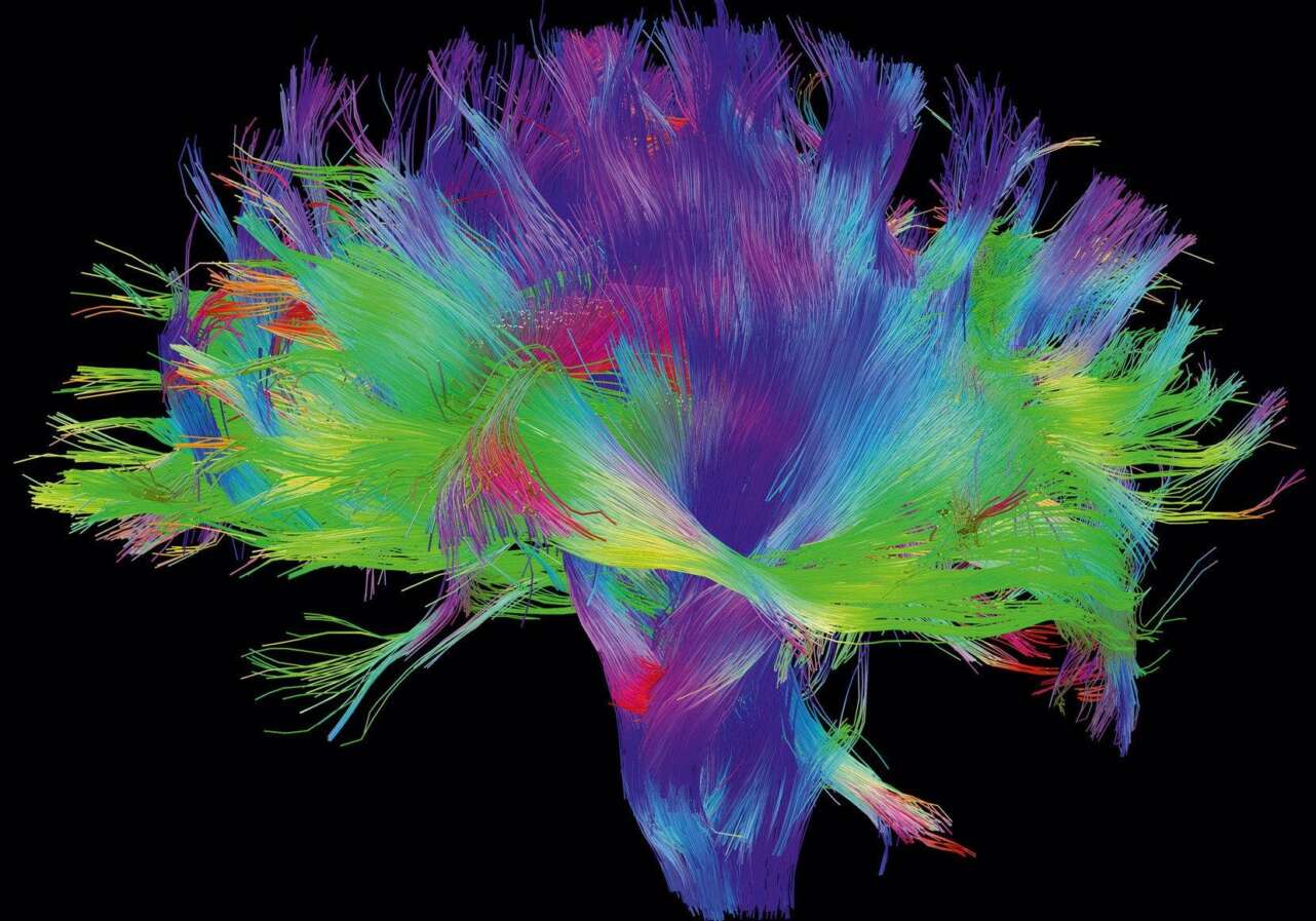 SÃ­, el cerebro tambiÃ©n tiene su mapa. Foto: Laboratory of Neuro Imaging and Martinos Center for Biomedical Imaging