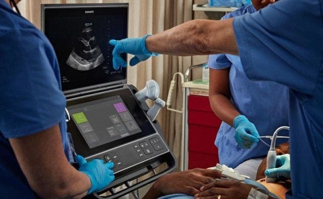 Un grupo de médicos utilizando el ecógrafo Sonosite PX para diagnosticar enfermedades