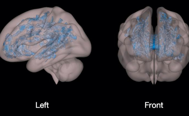 Cerebro de niños que pasan 2 horas diarias frente a una pantalla. Hospital Infantil de Cincinatti