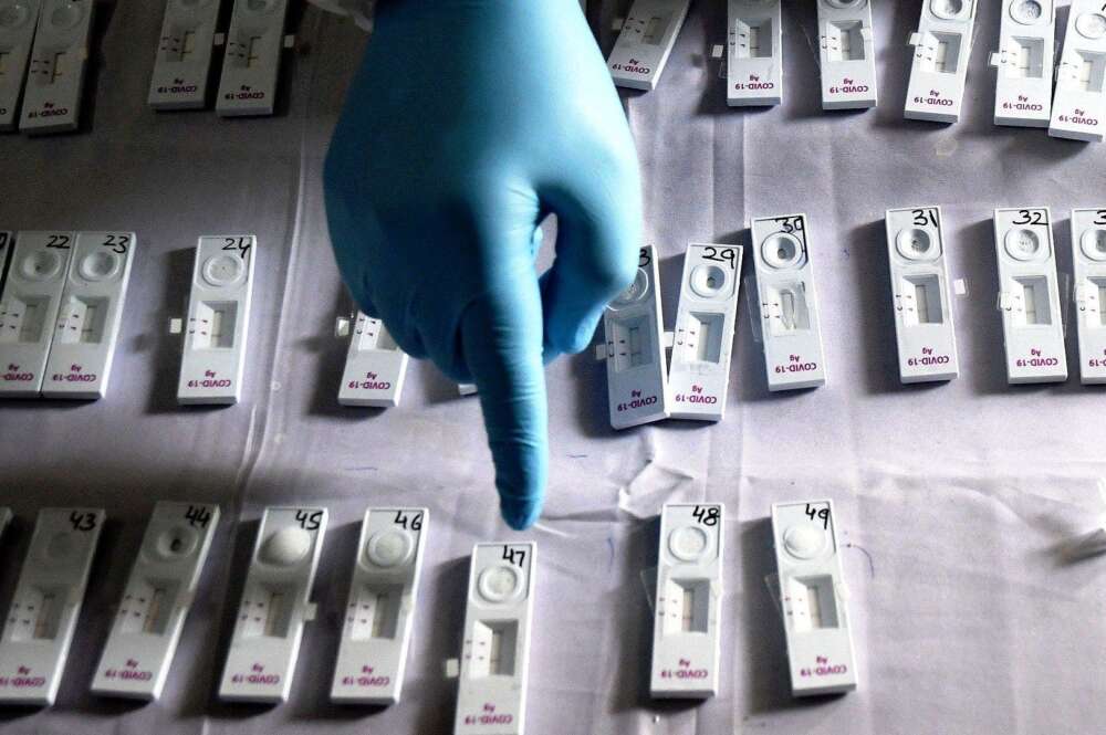 Un profesional manipula test de antígenos del coronavirus, como los que se empezarán a utilizar en farmacias y clínicas dentales de Madrid/EFE
