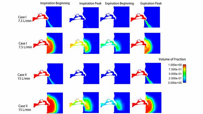 Visualización del aire respirado con y sin mascarilla considerando dos tasas de ventilación (7,5 y 15 litros/minuto)./ Heow Pueh Lee