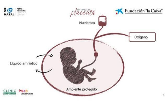 placenta artificial bcnatal